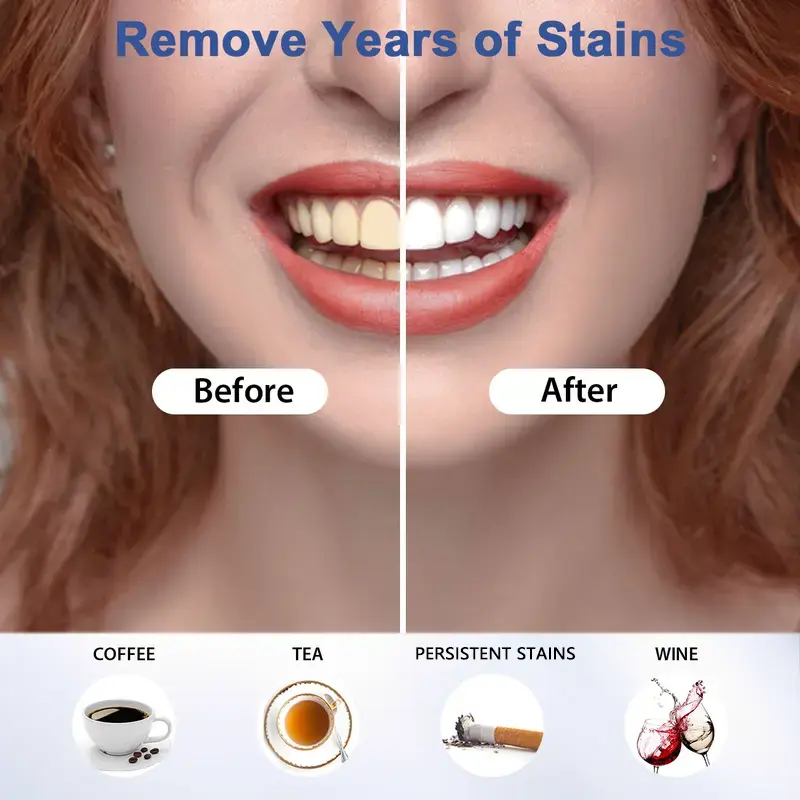 35%CP Teeth Whitening Pen - Image 4