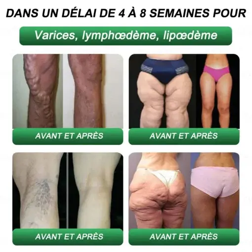 Gouttes Minceur & Santé - Image 4