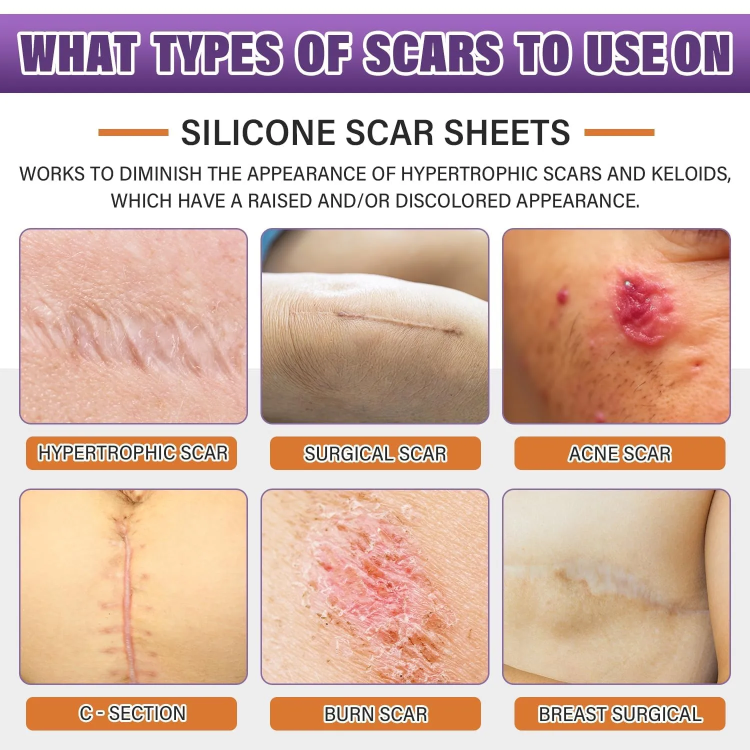 3-in-1 Microneedle Anti-Aging Patch - Image 3