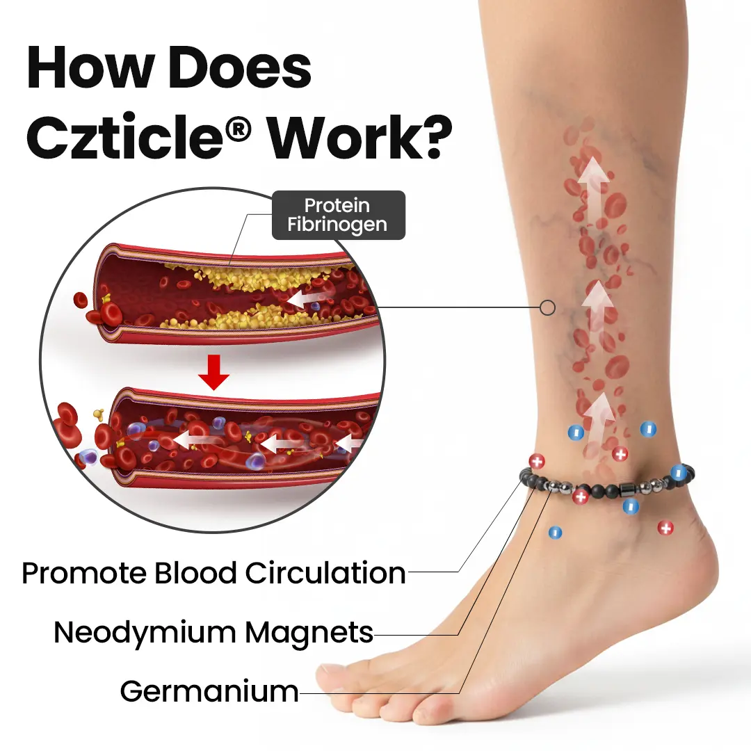 Leg Vein Magnet Ankle Bracelet - Image 3