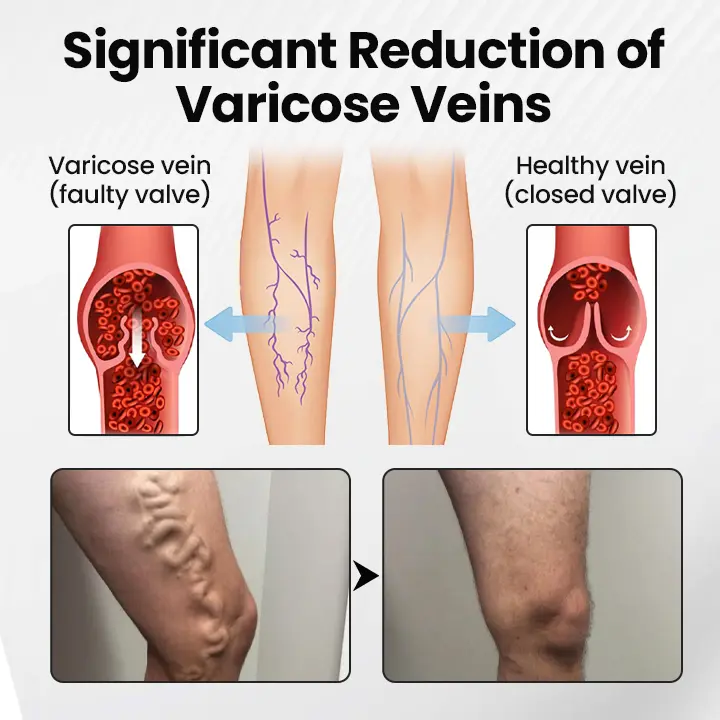 Leg Vein Magnet Ankle Bracelet - Image 4