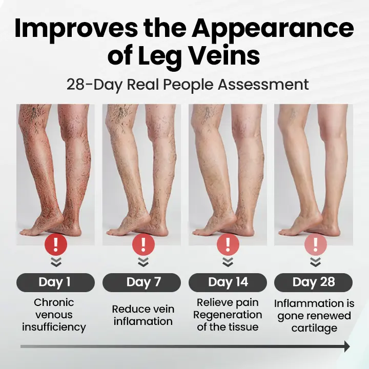 Leg Vein Magnet Ankle Bracelet - Image 6