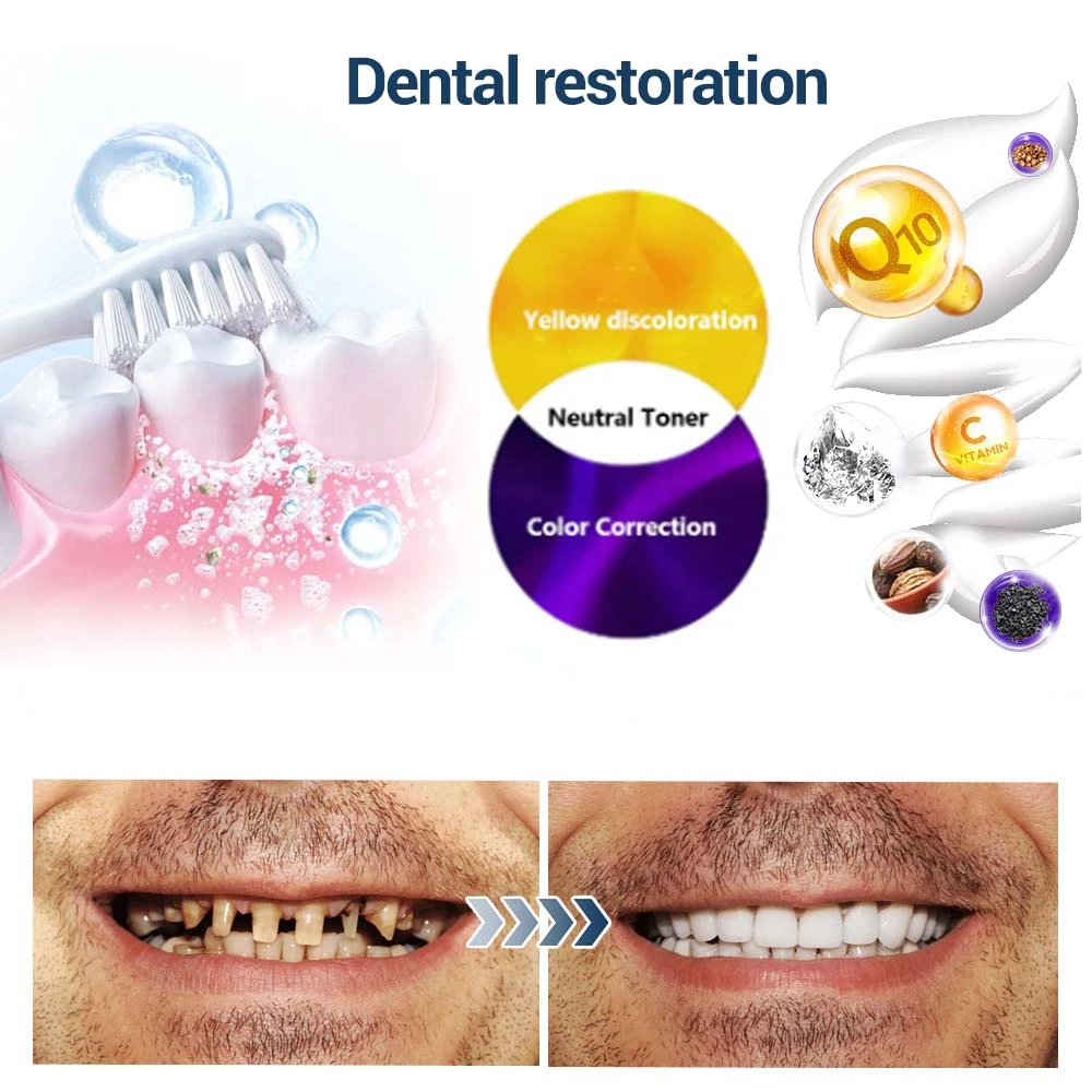 TeethRestoration Toothpaste Gel - Image 16