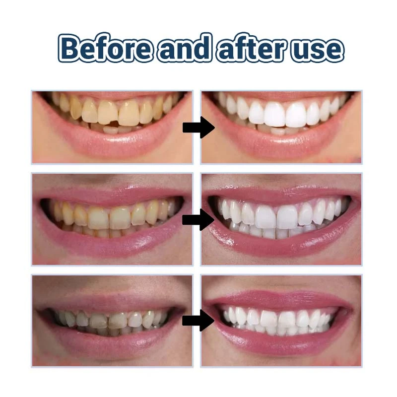 TeethRestoration Toothpaste Gel - Image 18
