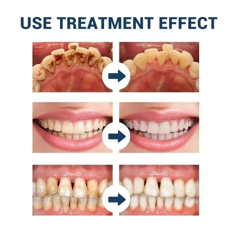 TeethRestoration Toothpaste Gel - Image 21