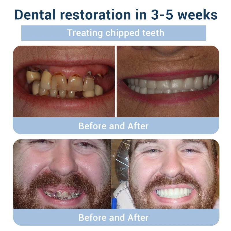 TeethRestoration Toothpaste Gel - Image 7