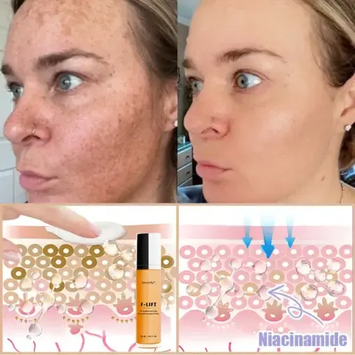 F-LIFT Anti-Wrinkle Firming Cream - Image 8