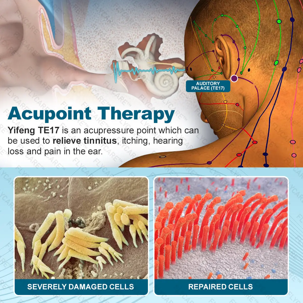 TinniCalm Tinnitus Treatment Ear Patch - Image 5