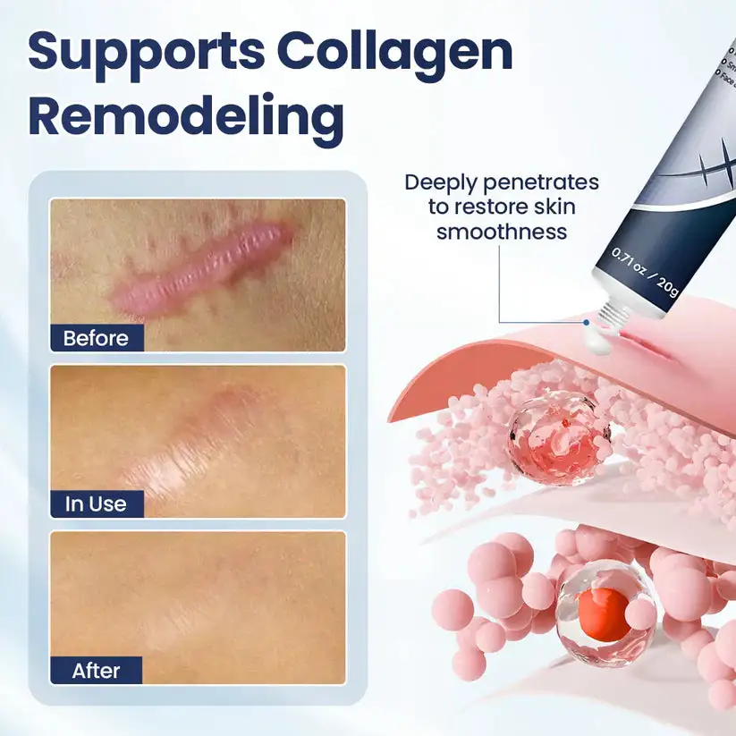 Texture Repair Gel - Image 5