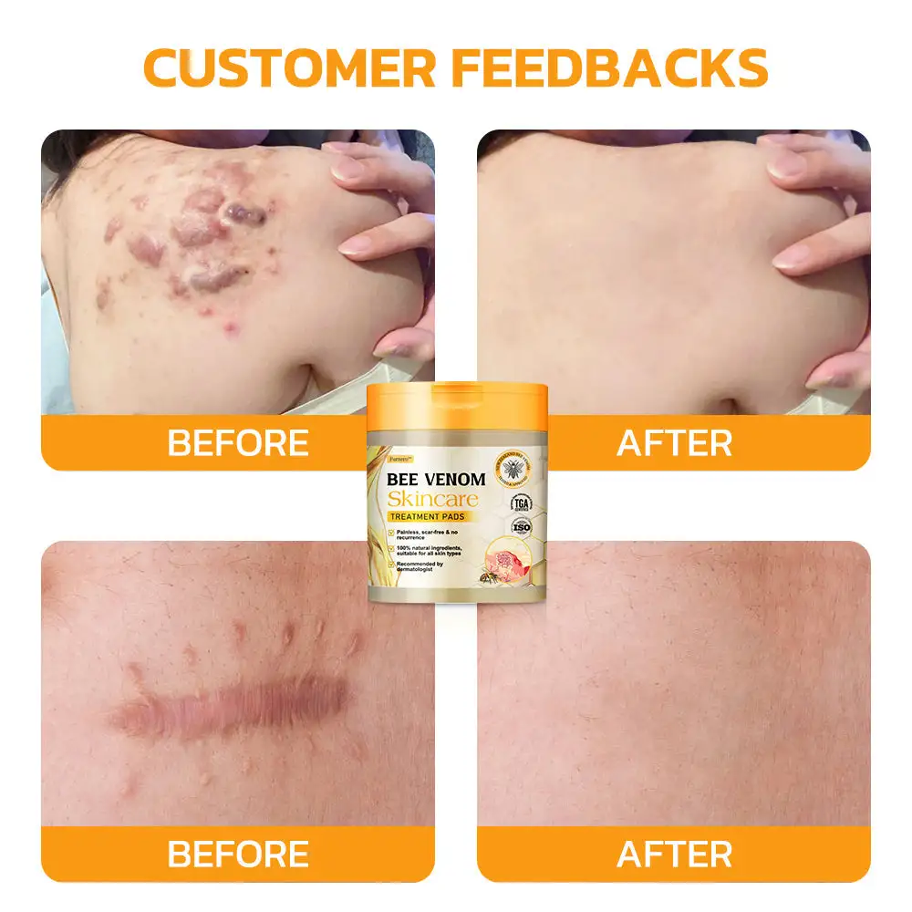Bee Venom Skincare Treatment Pads - Image 8