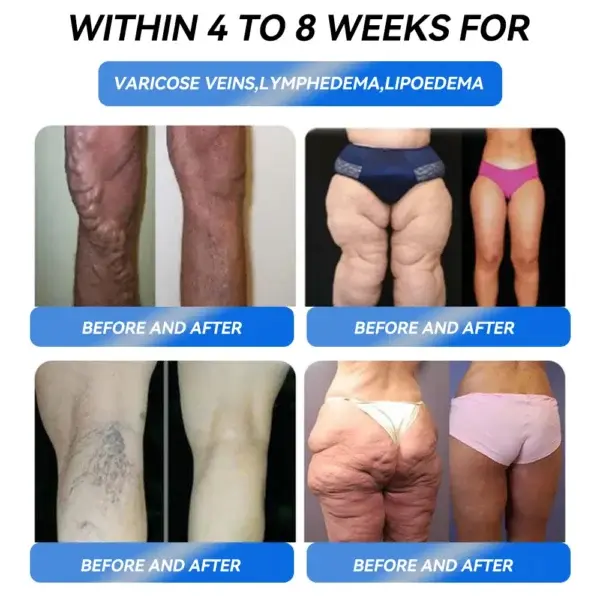 Weight Loss Oral Solution - Image 5