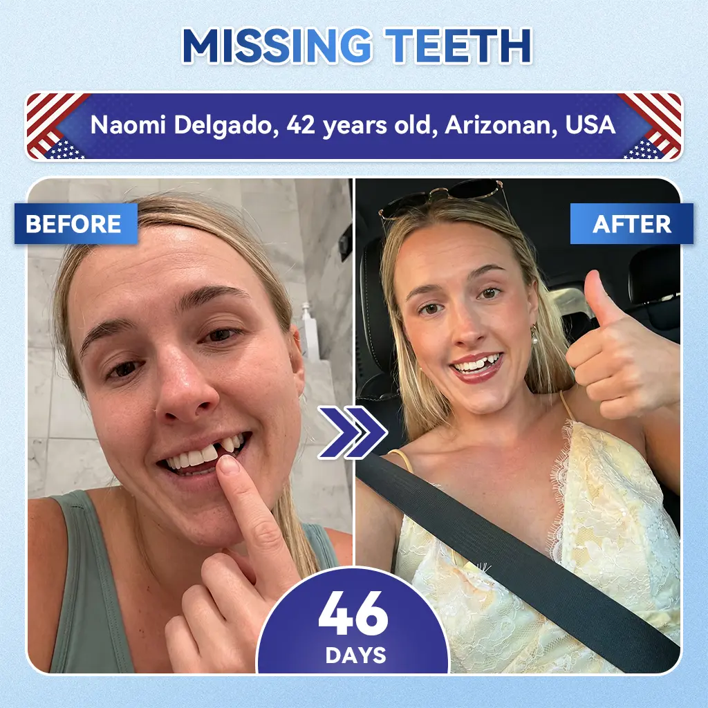 Tideglusib Fast‑Dissolving Tooth & Gum Repair Oral Strips - Image 11