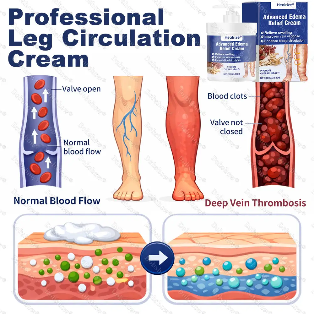 Advanced Edema Relief Cream - Image 3