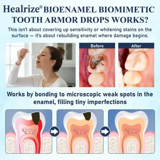 BioEnamel Biomimetic Tooth Armor - Image 3