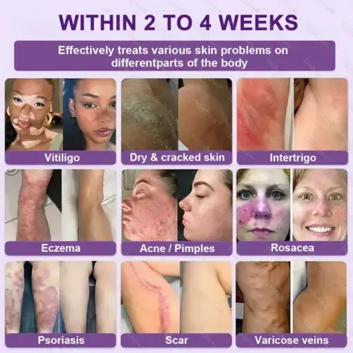 Biotin 10-in-1 Skin Restoration Cream - Image 3