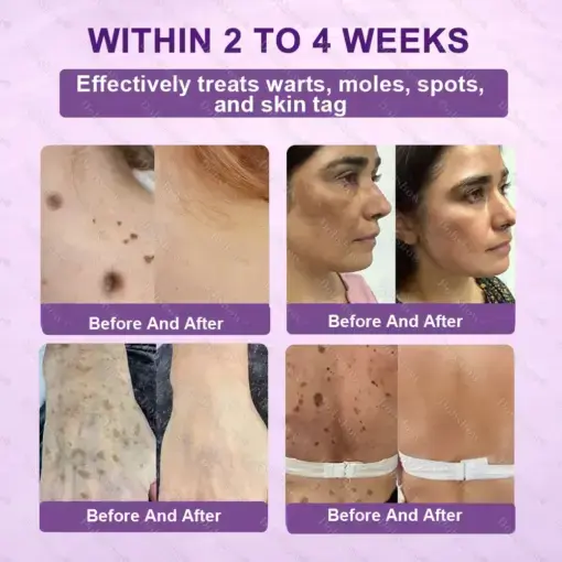 Biotin 10-in-1 Skin Restoration Cream - Image 4