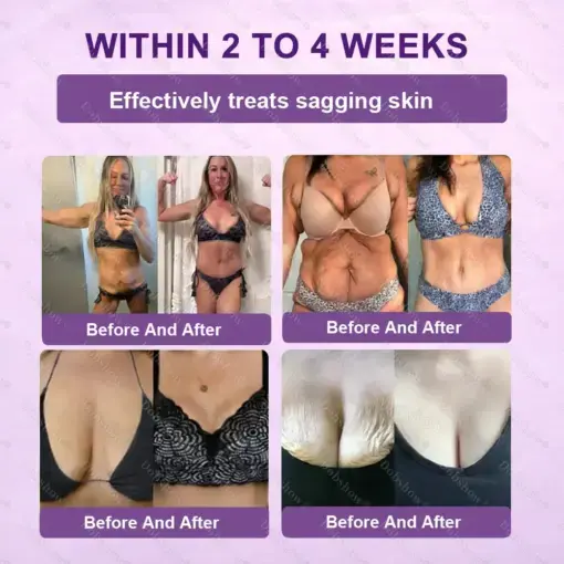 Biotin 10-in-1 Skin Restoration Cream - Image 5
