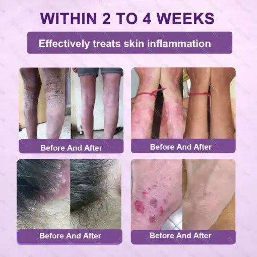 Biotin 10-in-1 Skin Restoration Cream - Image 6