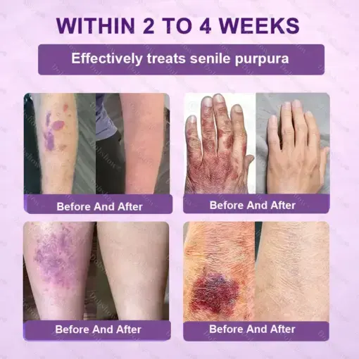 Biotin 10-in-1 Skin Restoration Cream - Image 7