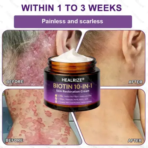 Biotin 10-in-1 Skin Restoration Cream - Image 9