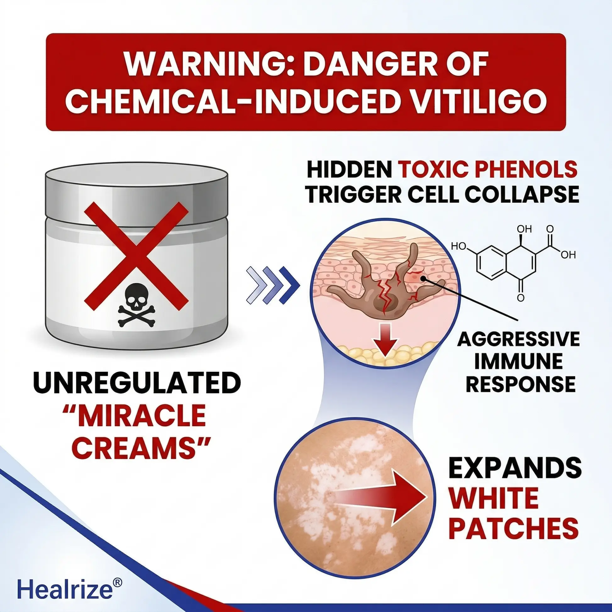 Rapid Repair Vitiligo Essence - Image 8
