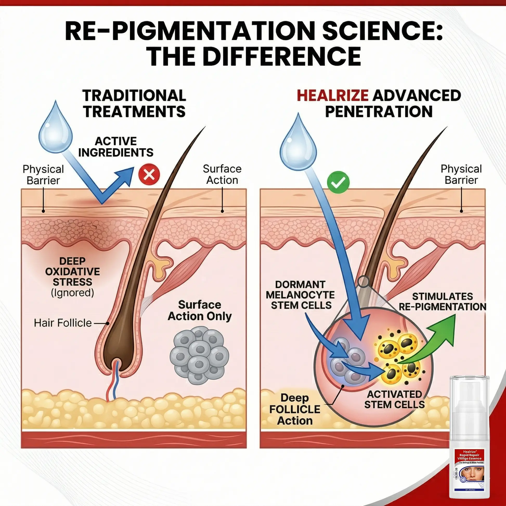 Rapid Repair Vitiligo Essence - Image 9