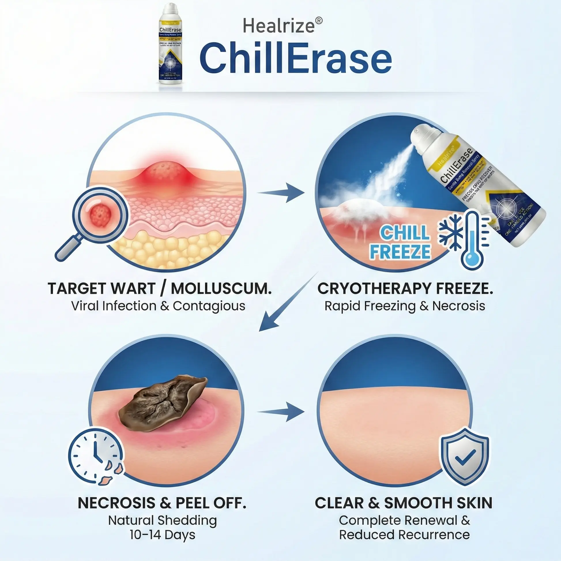 ❄️𝙎𝙥𝙚𝙘𝙞𝙖𝙡 𝙋𝙧𝙤𝙢𝙤𝙩𝙞𝙤𝙣 | ChillErase Gentle Bump Renewal Spray - Image 4