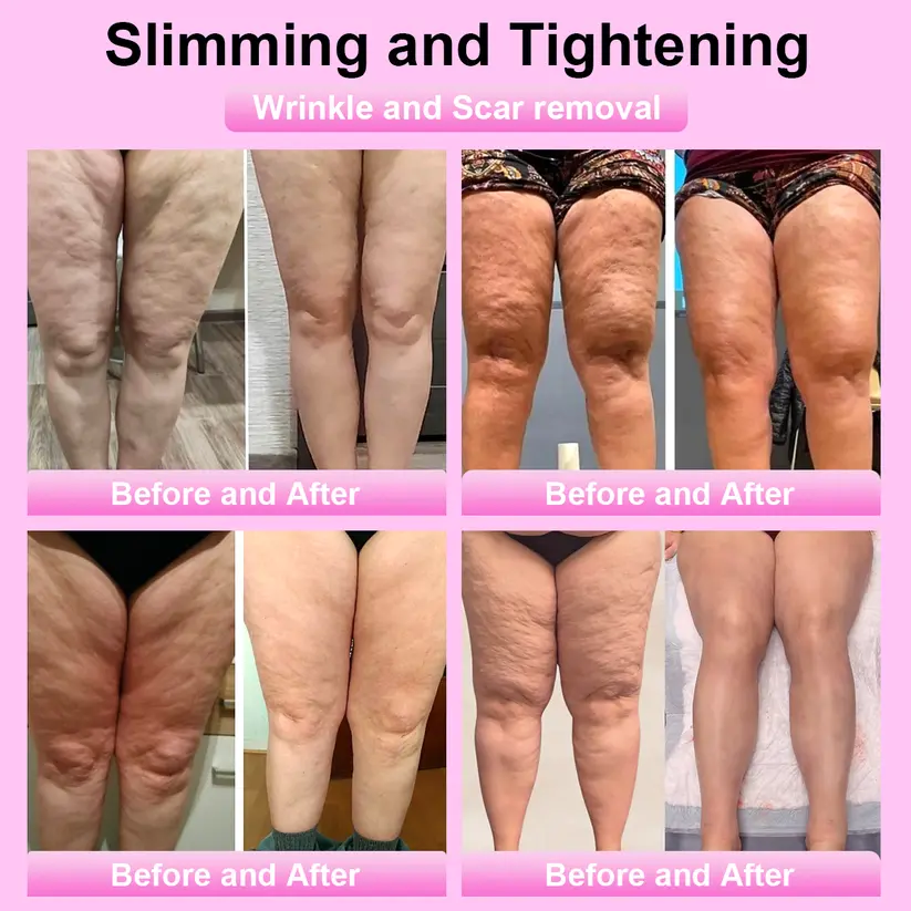 Advanced Fat-Burning & Firming Cream - Image 4
