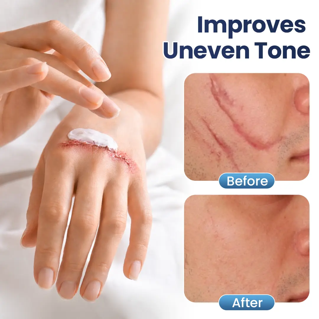 Texture Repair Gel - Image 7