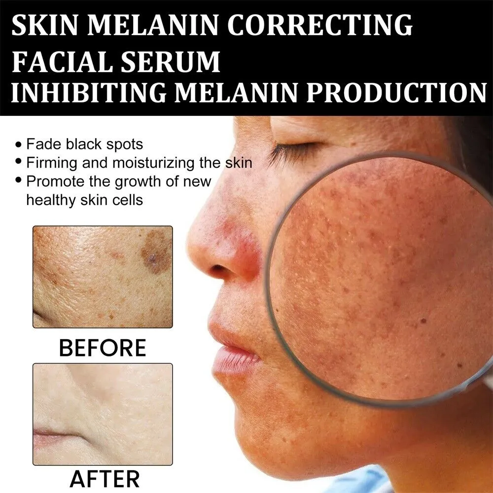 Niacinamide Brightening Serum - Image 3