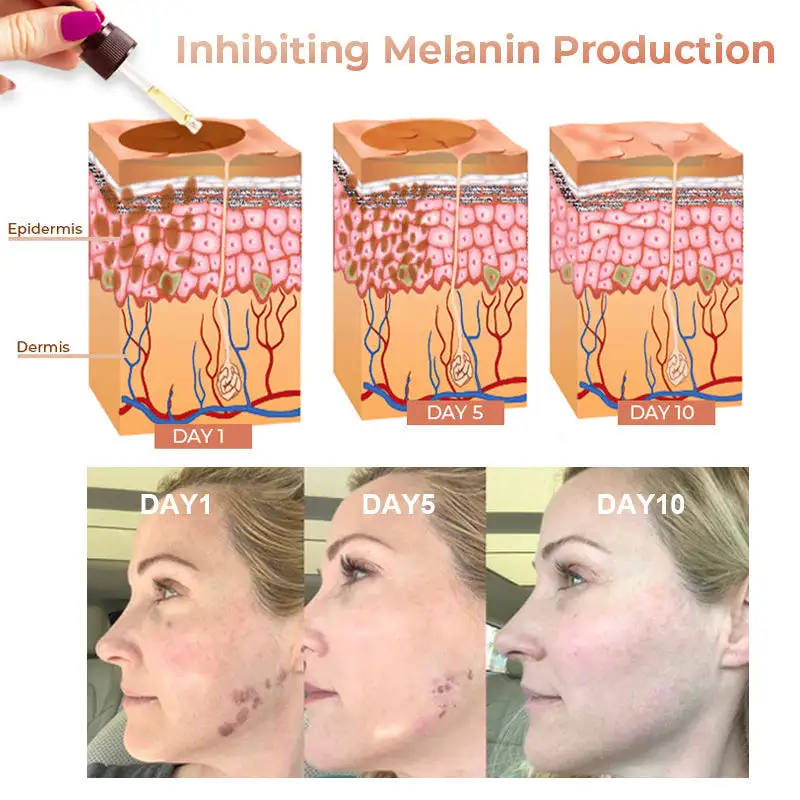 Niacinamide Brightening Serum - Image 5