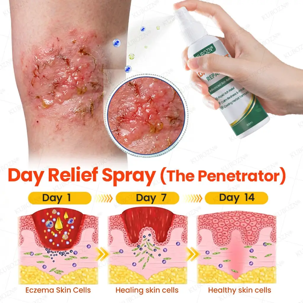 Eczema Day & Night Repair System - Image 2