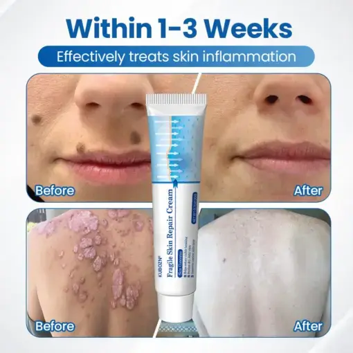 Fragile Skin Repair Cream - Image 3