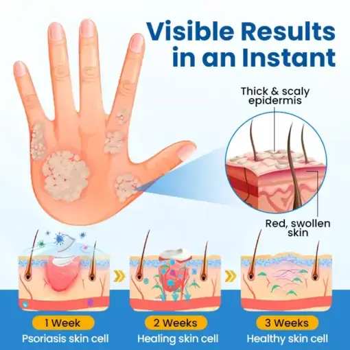 Fragile Skin Repair Cream - Image 6