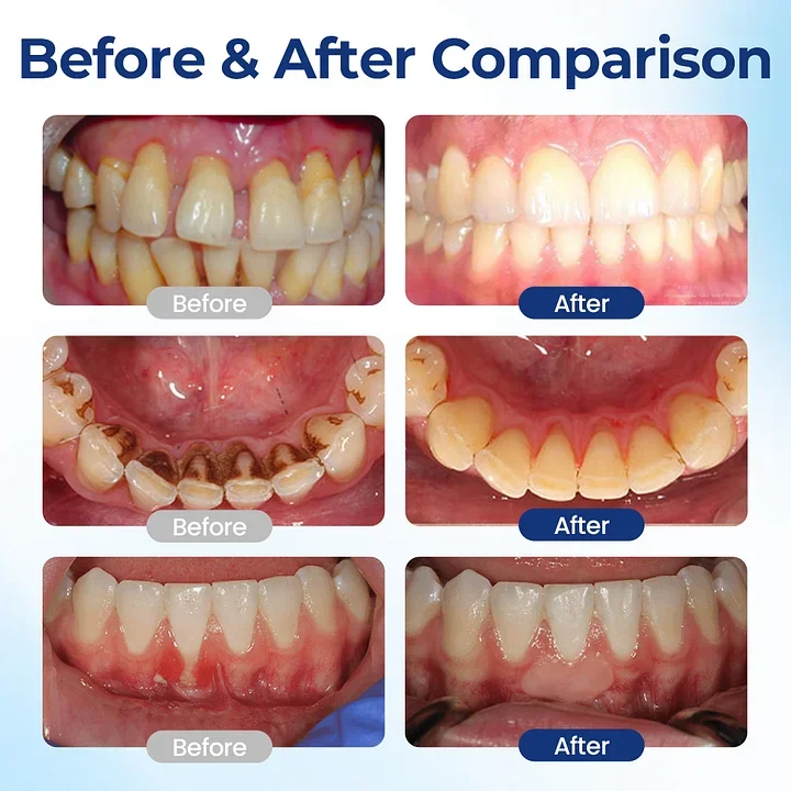 Apisin Oral Repair Solution - Image 6