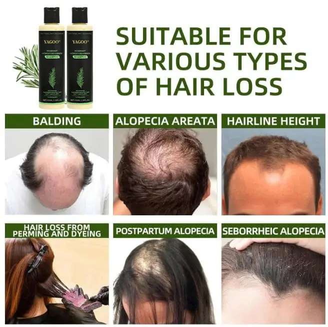 Rosemary Hydrolyzed Shampoo - Image 7