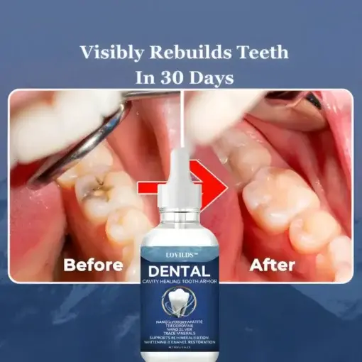 Advanced Enamel Repair & Whitening Kit - Image 4