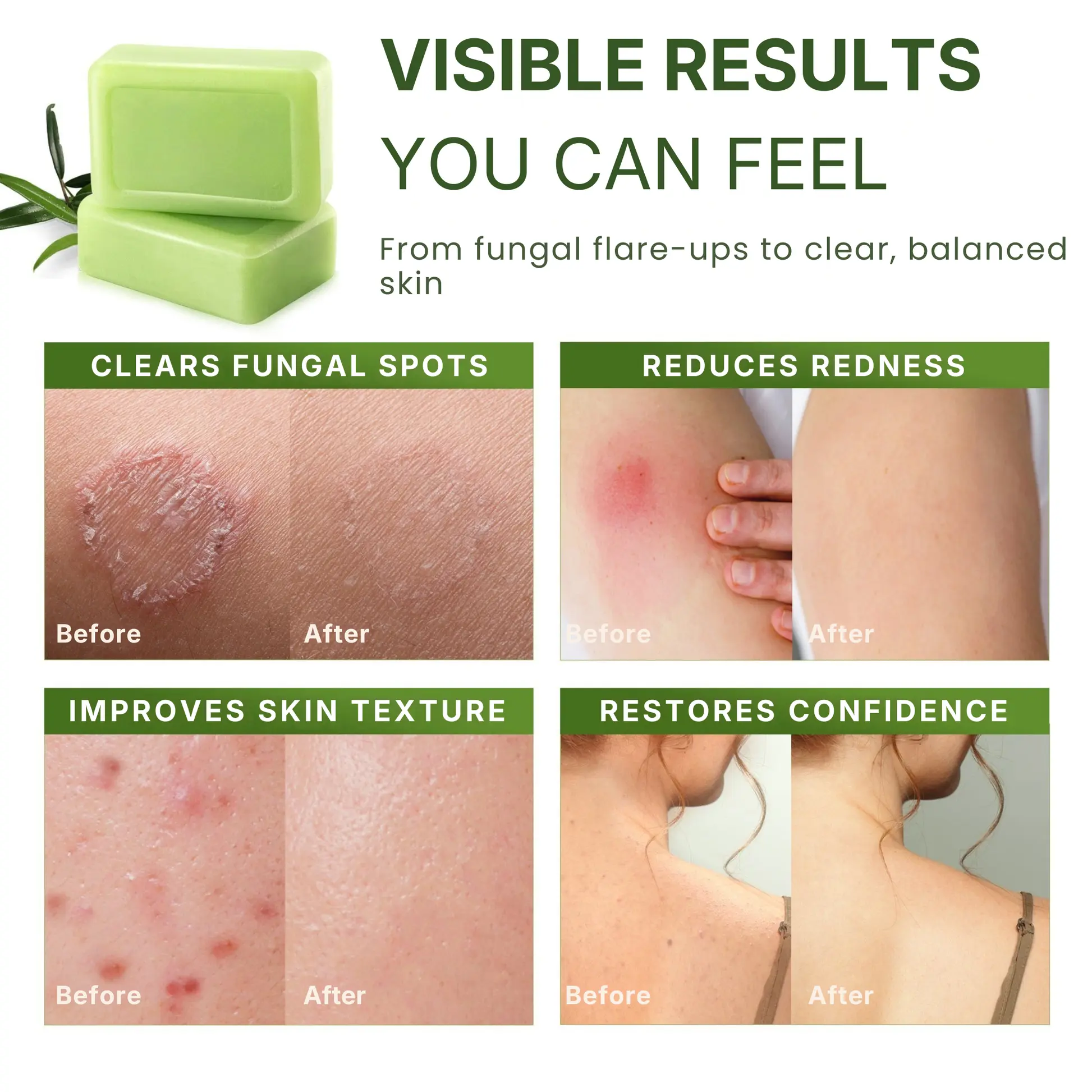 Antifungal Purifying Soap - Image 6