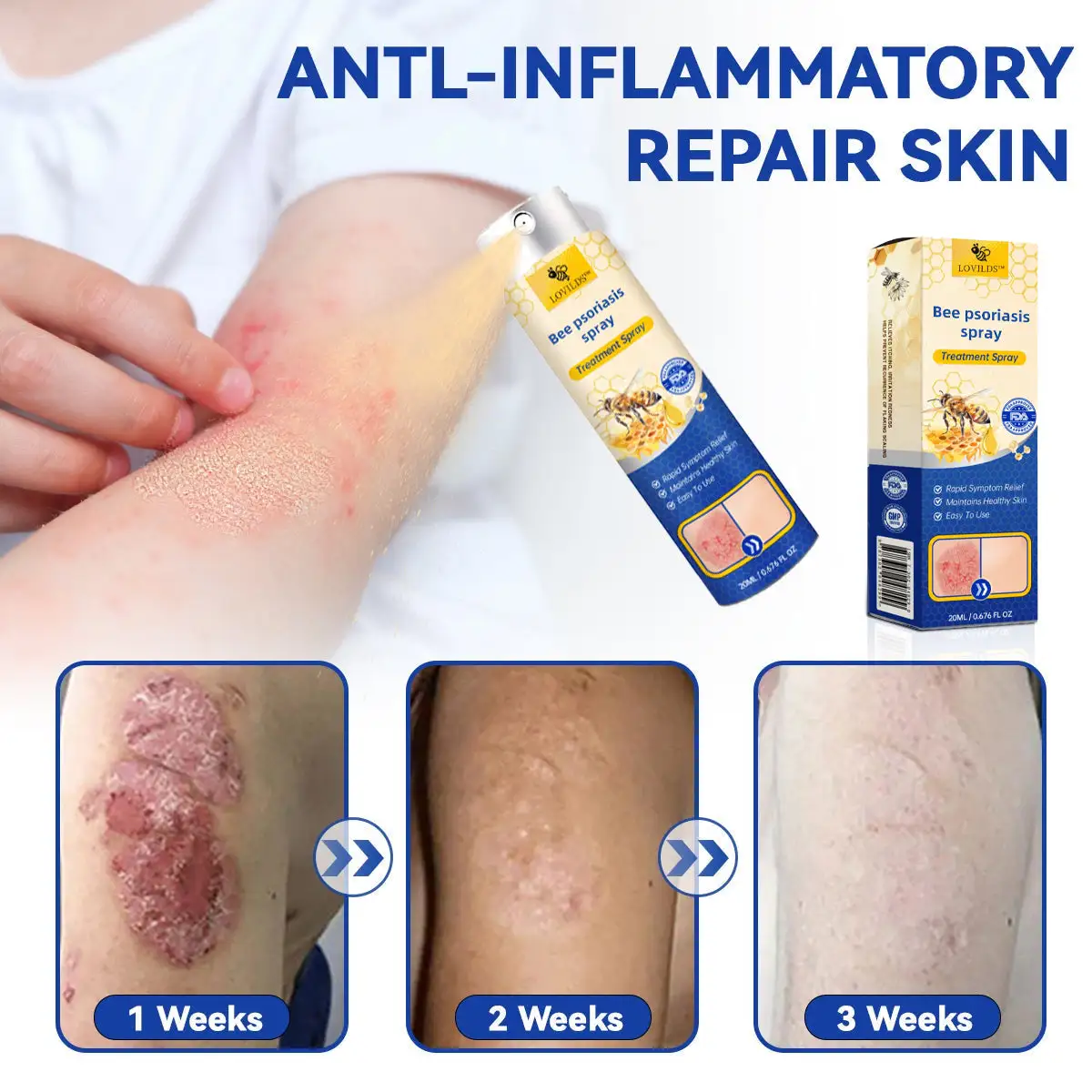 PsoriaHeal Bee Psoriasis Treatment Spray pro - Image 6