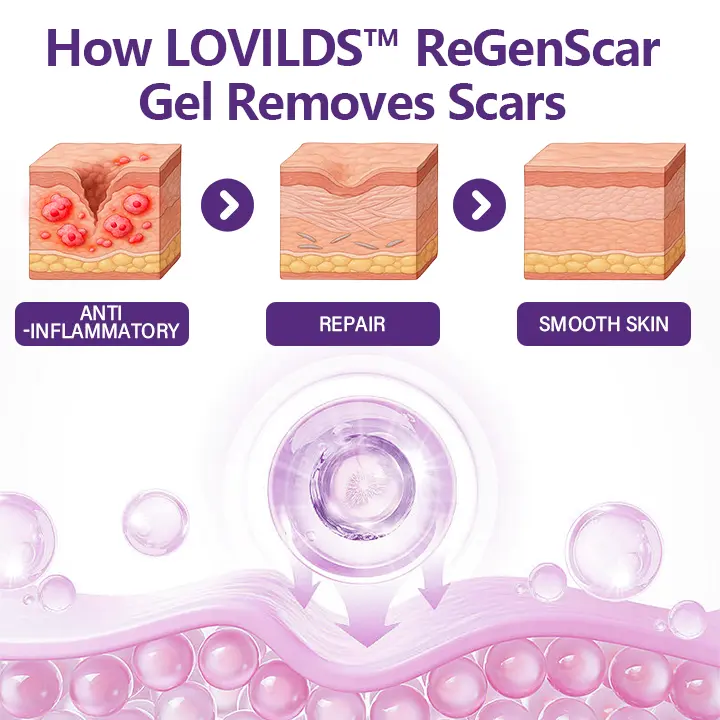 ReGenScar Stem Cell Repair Gel - Image 5