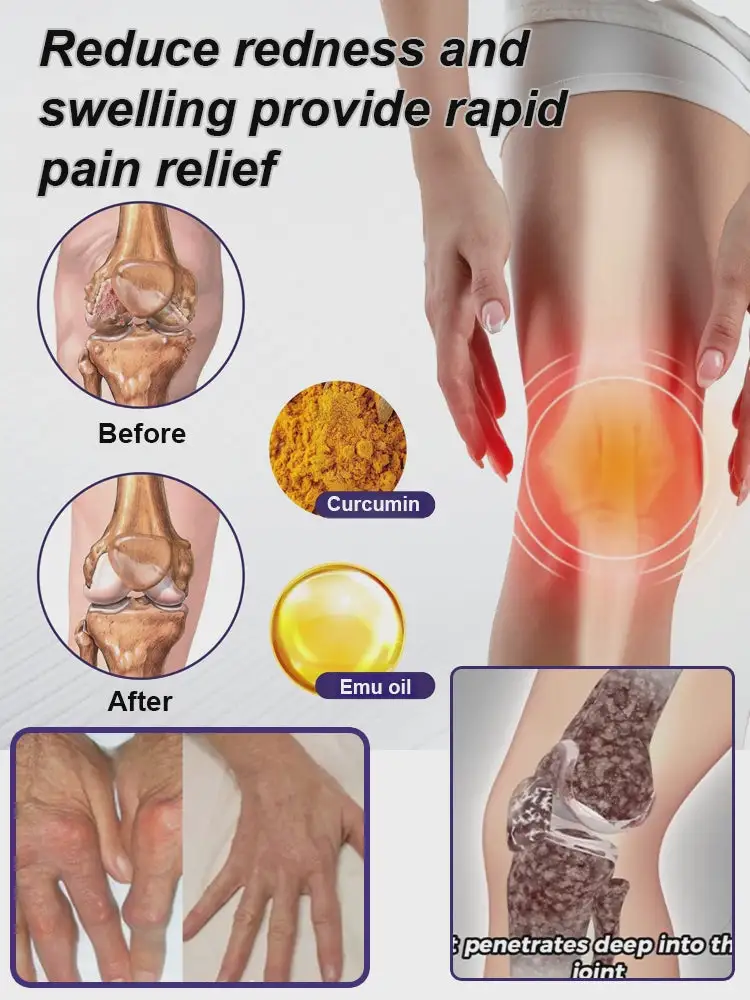 Turmeric & Emu Oil Arthritis Soothing Pain Relief Massage Gel - Image 2