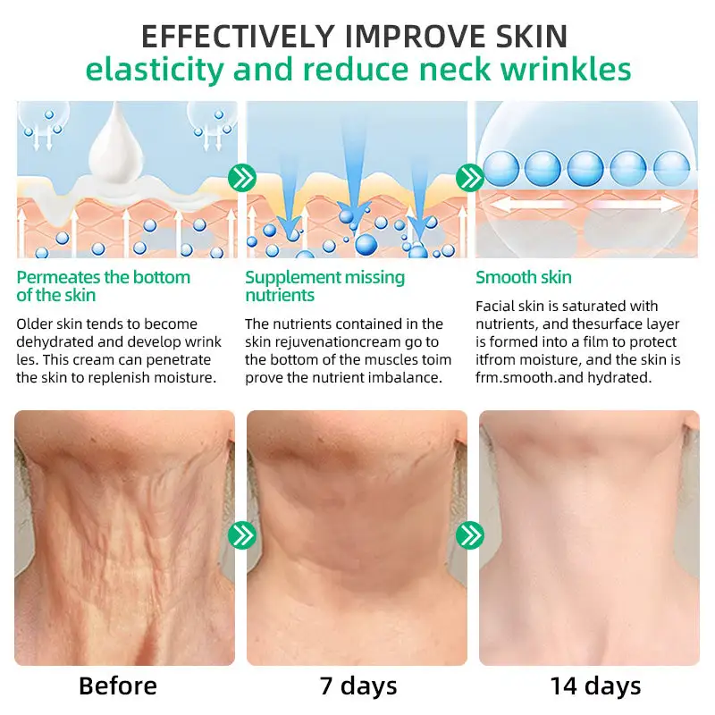 Wrinkle Removel Cream,Address Crepe & Sagging - Image 10