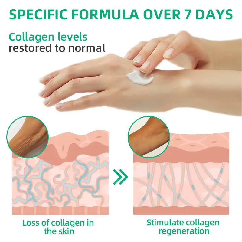 Wrinkle Removel Cream,Address Crepe & Sagging - Image 11
