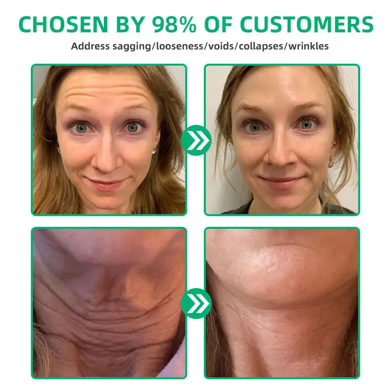 Wrinkle Removel Cream,Address Crepe & Sagging - Image 8