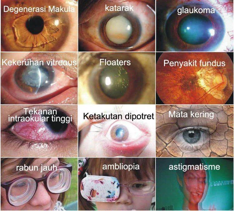 Japan Vision Drops — Rapidly Heals All Eye Conditions & Restores Vision - Image 4