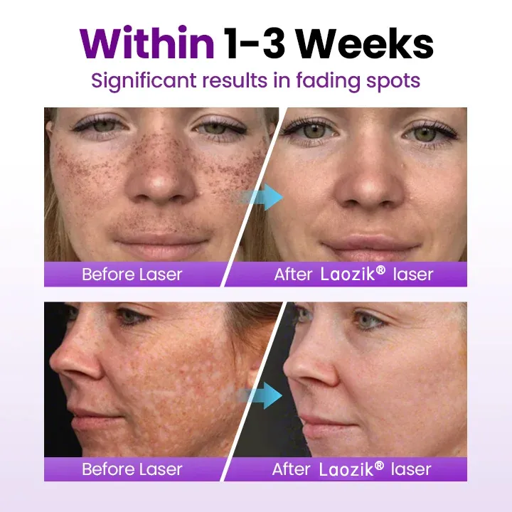 StainFade Facial Serum with Probiotics - Image 4