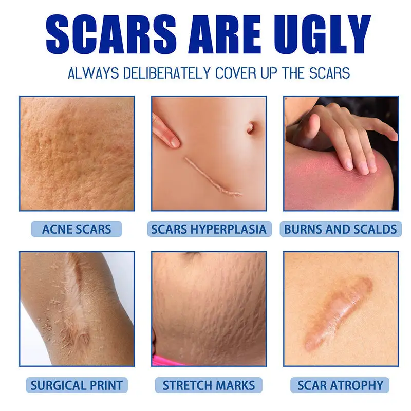Scar Repair Cream - Image 4