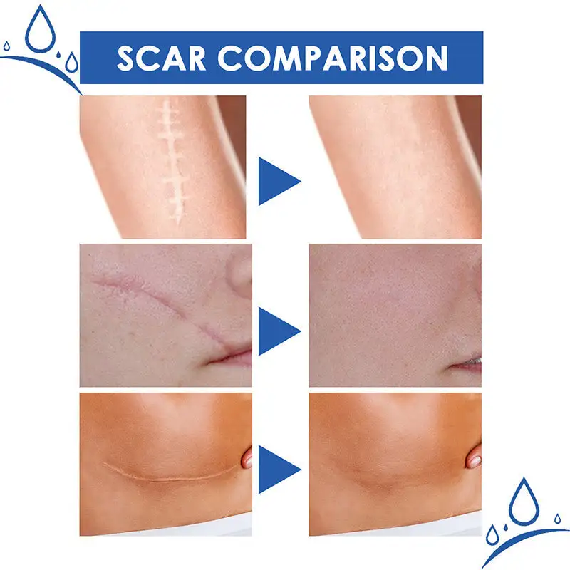 Scar Repair Cream - Image 7
