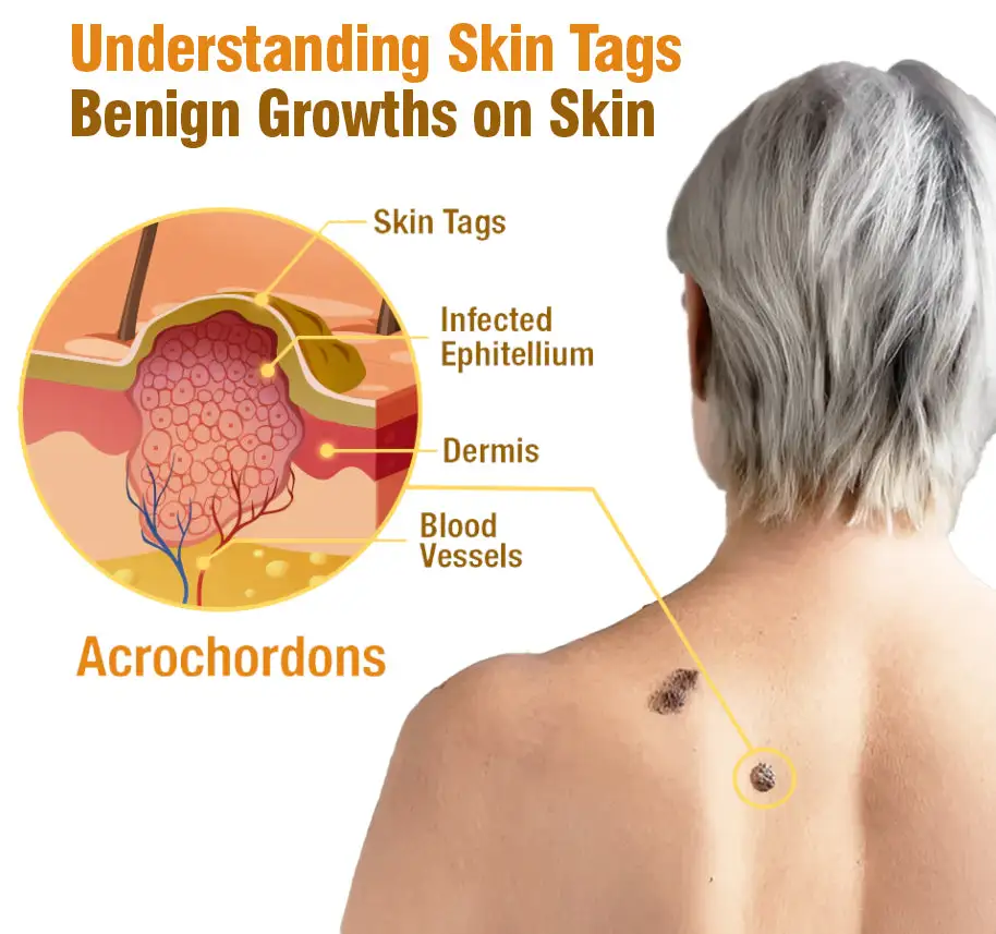 Australian Bee Venom Tags Removal Cream - Image 7