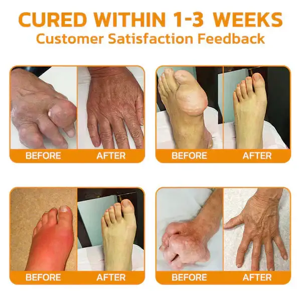 Pain-Relief Bone Healing Ointment - Image 5